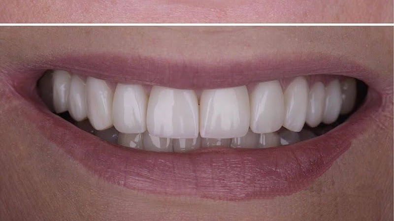 Foto 2 de FGodonto Clínica Odontológica - Odontoprev, Bradesco Dental e Sulamérica Odonto