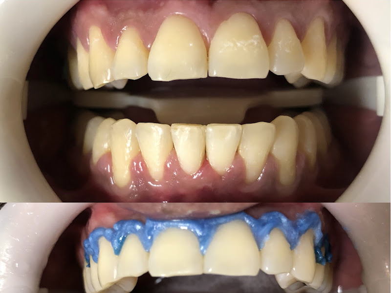 Foto 11 de Fibro Odontologia