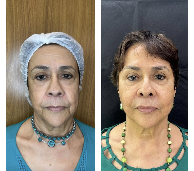 Foto 3 de Figueirôa Odontologia Avançada