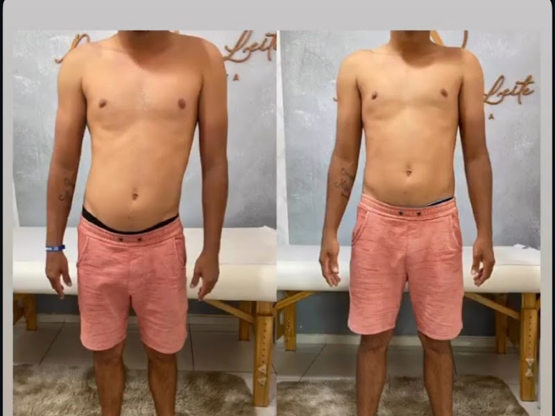 Foto 3 de Fisioclínica