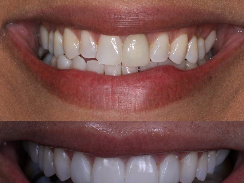 Foto 6 de Flávia Ribeiro Odontologia | Endodontia | Ortodontia | Prótese | Implantes | Harmonização