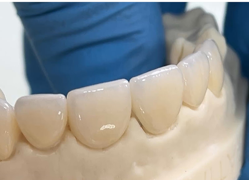 Foto 3 de Flores Odontologia/Implantes dentários e lentes de contato dental