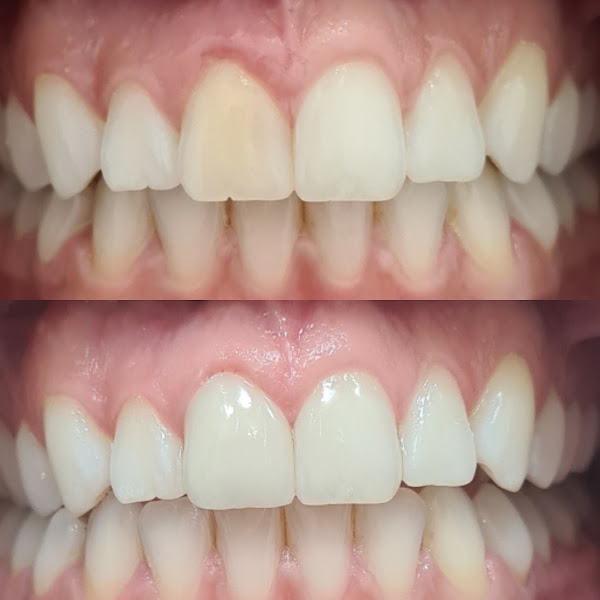 Foto 2 de Flos Odontologia Reabilitadora e Estética