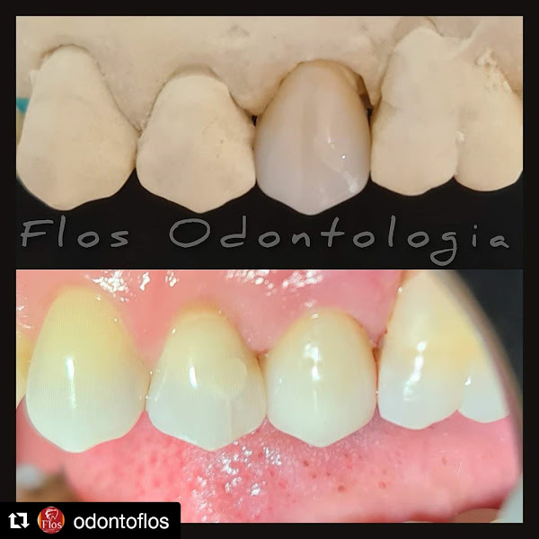 Foto 3 de Flos Odontologia Reabilitadora e Estética