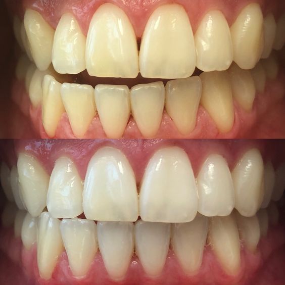 Foto 2 de FM Muccioli Odontologia Implantes Dentários Dentista na Mooca