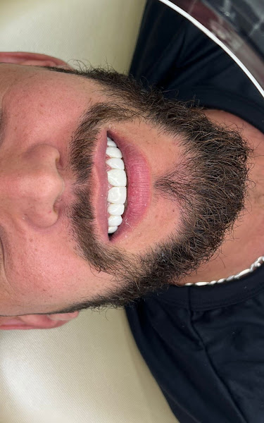 Foto 2 de Focus Clin implante e estética - Dentista Rio das Ostras