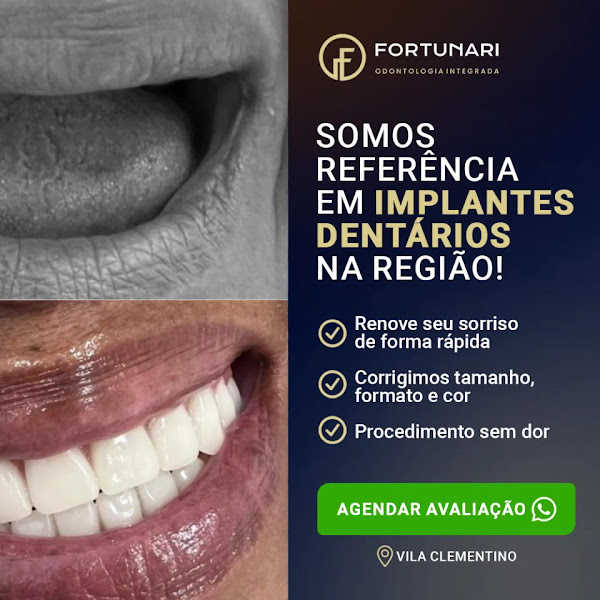 Foto 3 de Fortunari Odonotologia Integrada | Referência em Prótese e Implantes | Especialistas em Esculpimento Dental