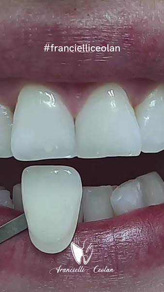 Foto 2 de Francielli Ceolan Odontologia Especializada