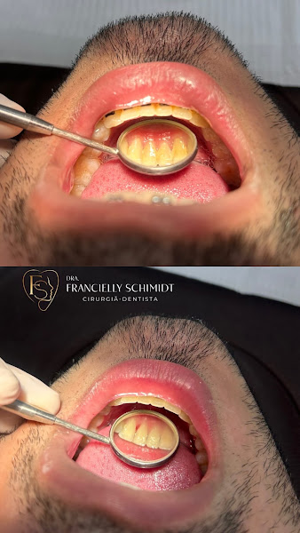 Foto 2 de Francielly Schimidt- Dentista e Harmonização facial