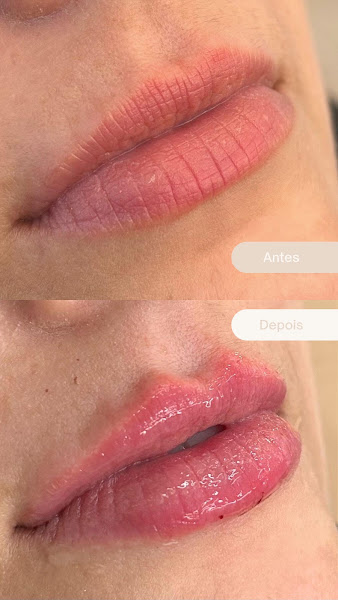 Foto 3 de Francielly Schimidt- Dentista e Harmonização facial