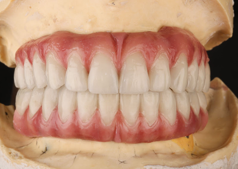 Foto 2 de Franza Implantes Guarujá