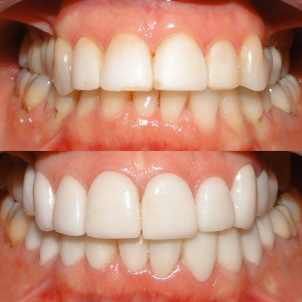 Foto 3 de Franzoi Reabilitação Oral e Estética