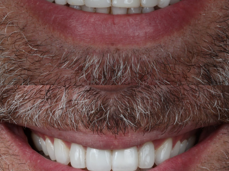 Foto 3 de Frasnelli Odontologia