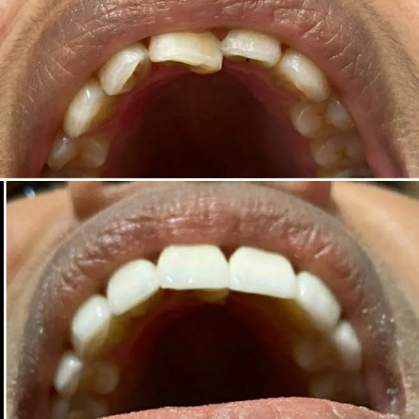 Foto 2 de Fraterna Odontologia