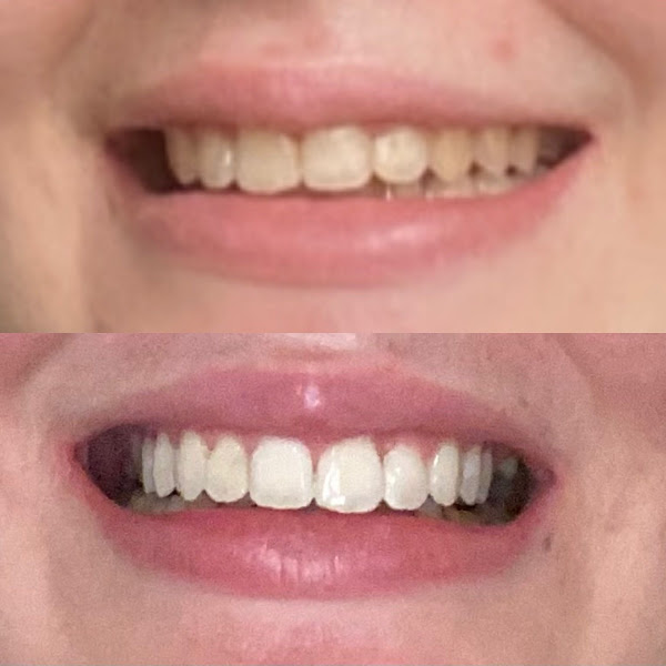 Foto 4 de Fraterna Odontologia