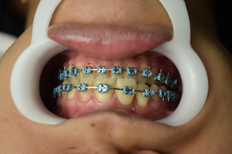 Foto 3 de FREITAS RABELO ODONTOLOGIA ESPECIALIZADA