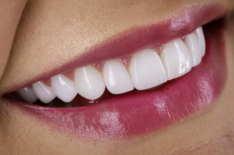 Foto 3 de Fries Odontologia