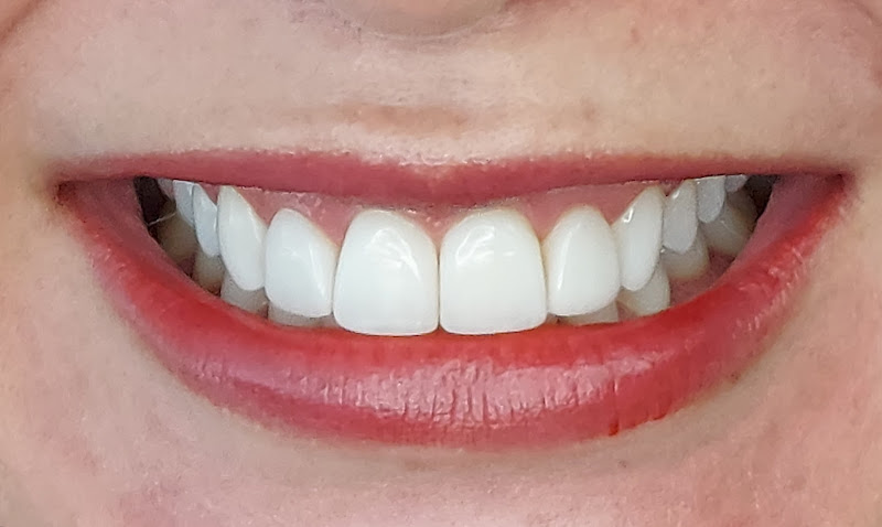 Foto 3 de Frogeri Ortodontia