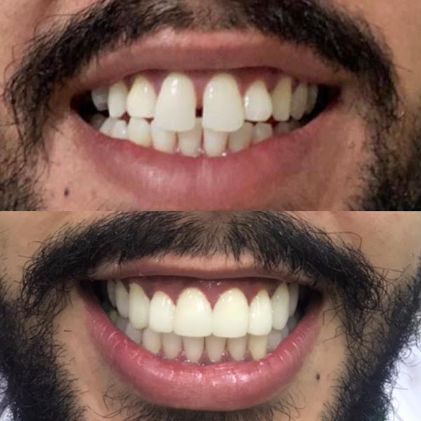 Foto 3 de Fs Odontologia