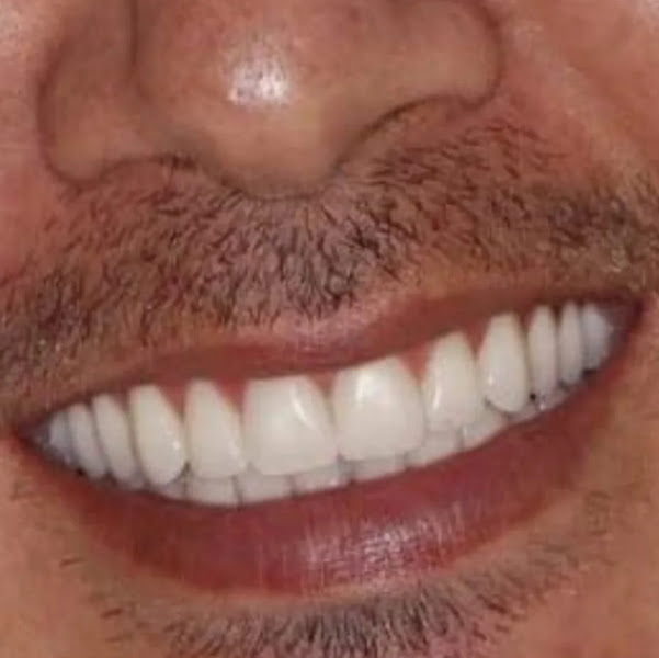 Foto 2 de FS protetico