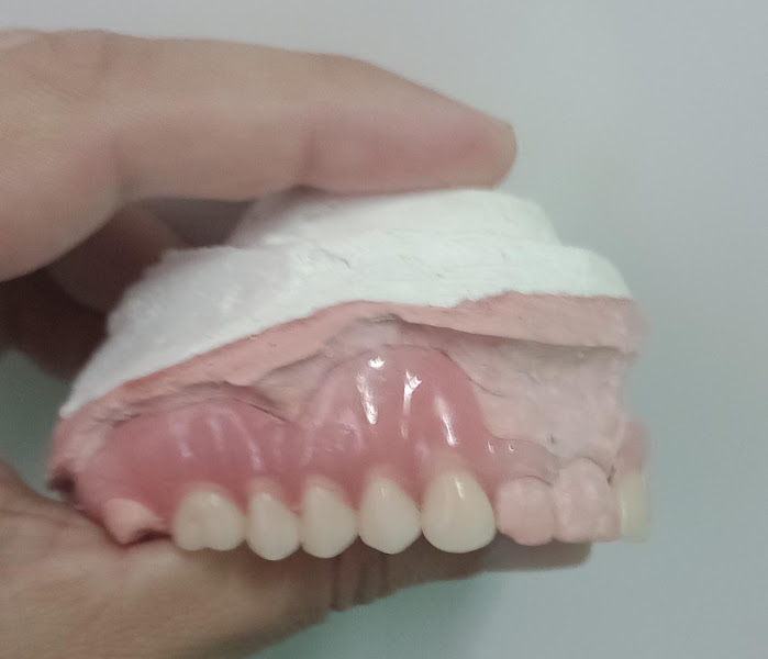 Foto 3 de FS protetico