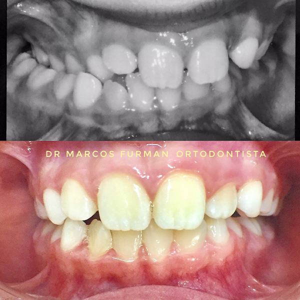 Foto 3 de Furman Clinic Odontologia Curitiba