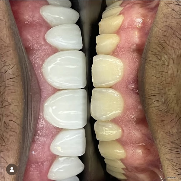 Foto 3 de G4 odontologia