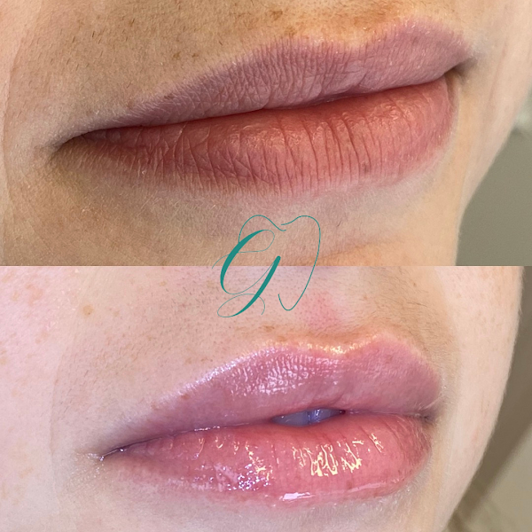 Foto 2 de Gabriela Carvalho Odontologia e Harmonização Facial