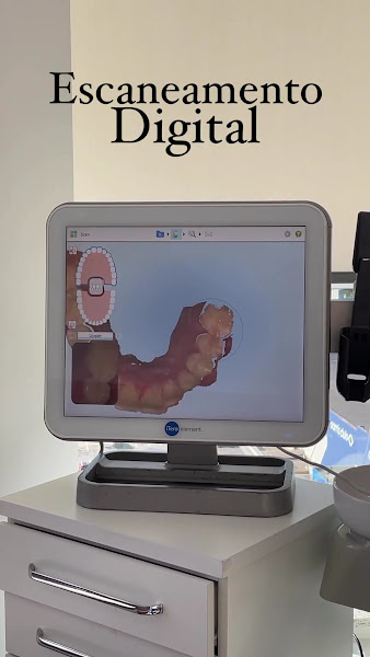 Foto 3 de Gabriela Cavalheiro Ortodontia Invisalign