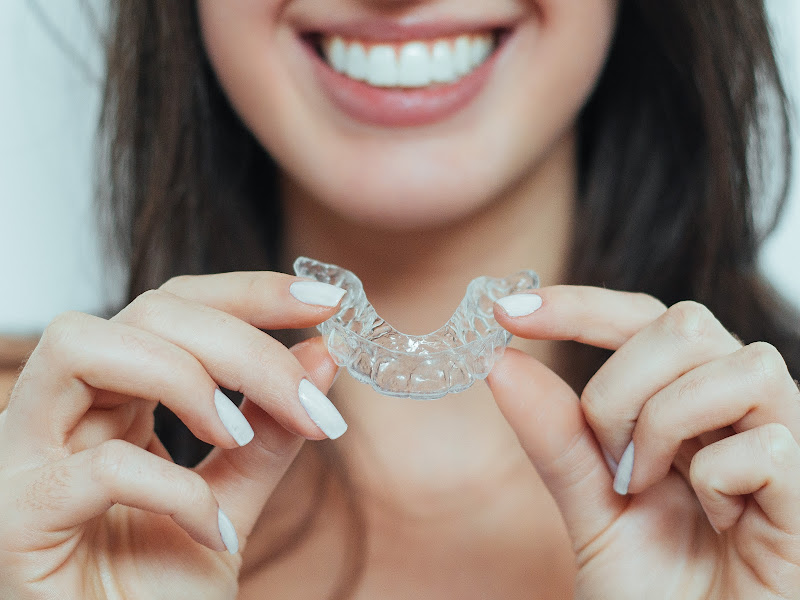 Foto 3 de Gaex Aligner - Aparelho Invisível