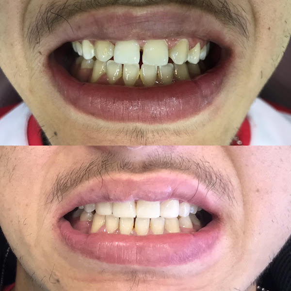 Foto 2 de Galitzki Odontologia