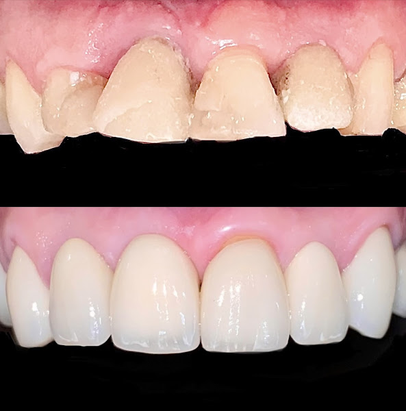 Foto 3 de Gama Odontologia