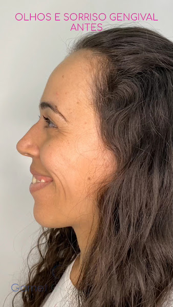 Foto 3 de Garnet Odontologia Saúde e Bem Estar