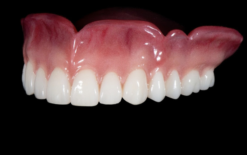 Foto 2 de GB Prótese Dentária