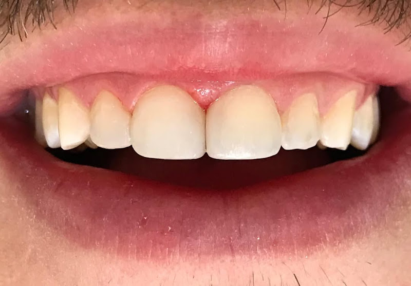 Foto 3 de GC Odontologia | Dentista em Linhares