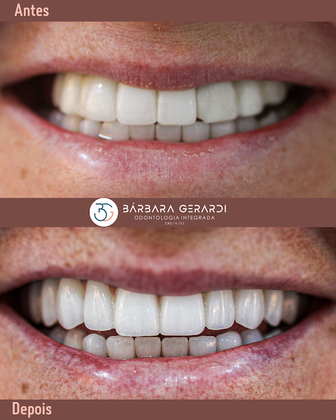 Foto 3 de Gerardi Odontologia Integrada e Implantes