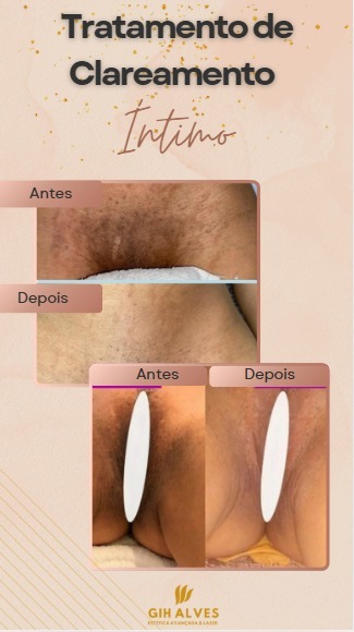 Foto 2 de Gih Alves Estética Avançada & Laser Indaiatuba/SP