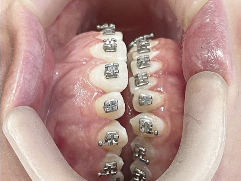 Foto 3 de Giovana Tiburski