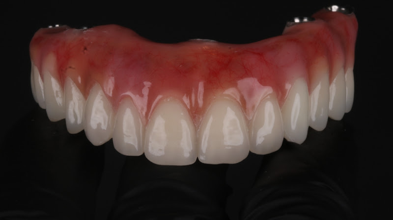 Foto 2 de Girlaine N Andrade