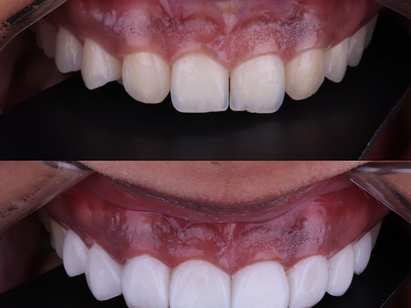 Foto 7 de Gisela Menezes Odontologia | Dentista em Campos dos Goytacazes