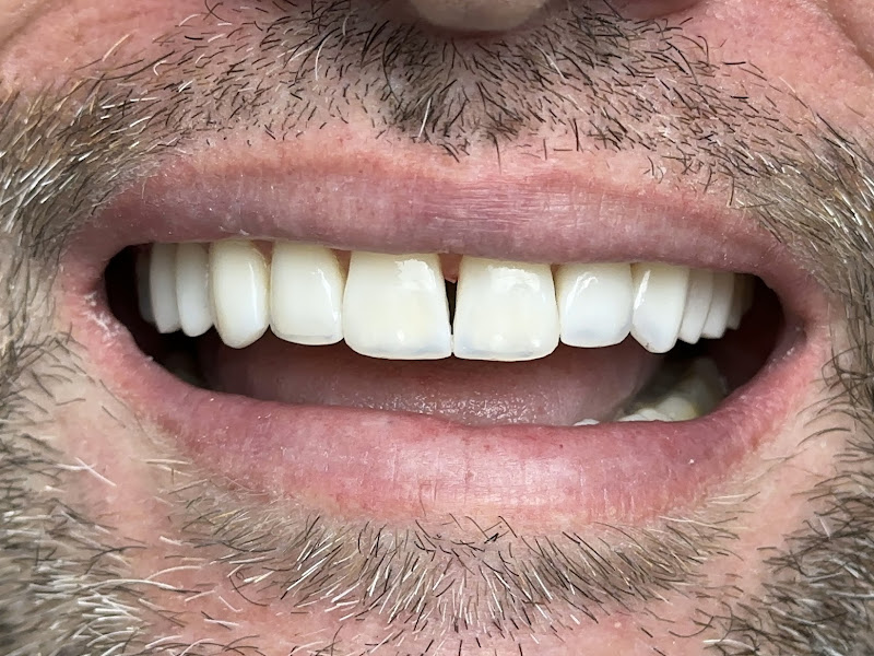 Foto 9 de GK Odontologia | Dentista, Implante, Canal, Gengiva, Estética dental e laser.