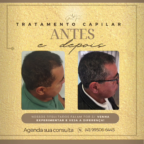 Foto 3 de Glow Face Estética Avançada - especializada em tratamento capilar