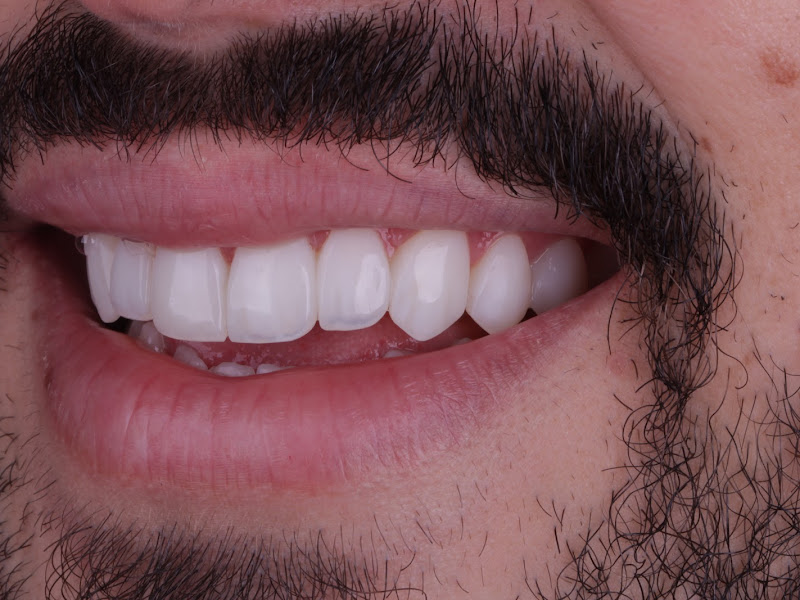 Foto 3 de Gnation Odontologia Especializada