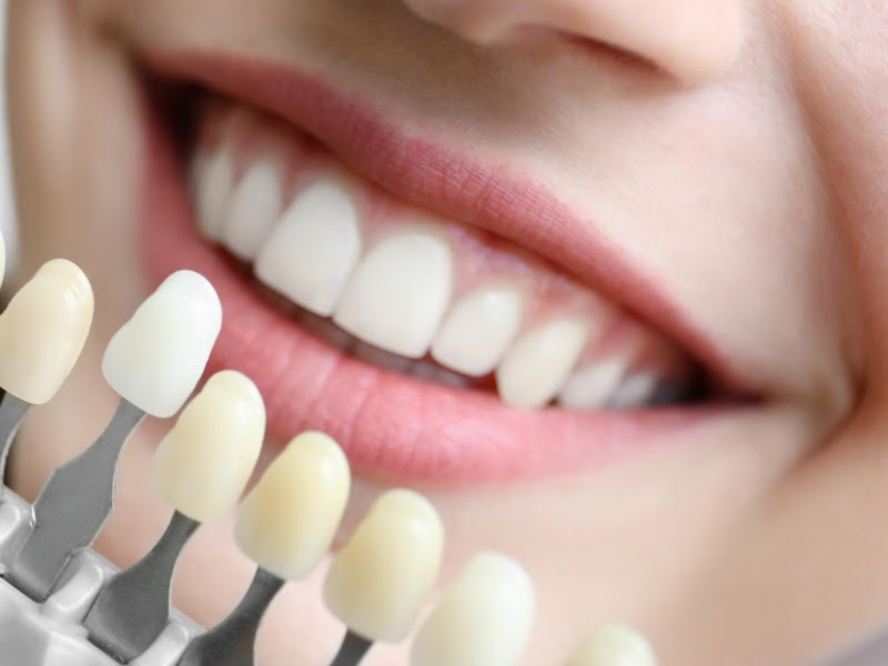 Foto 8 de GOE - Grupo de Odontologia Especializada