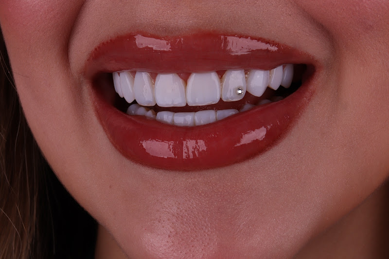 Foto 2 de Gold Smile Odontologia