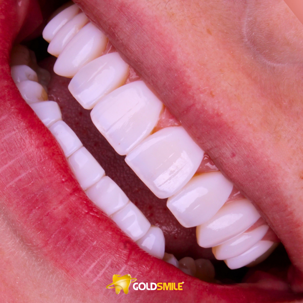 Foto 3 de Gold Smile Odontologia