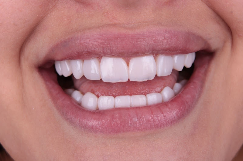 Foto 3 de Gold Smile Odontologia