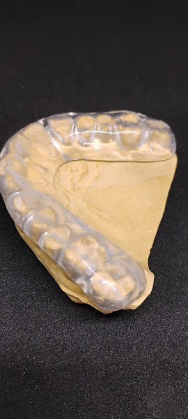 Foto 3 de Goncalves Prótese Dentárias LTDA