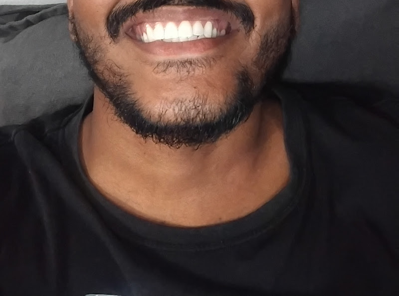 Foto 3 de GOU Odonto Aparecida de Goiânia - Garavelo