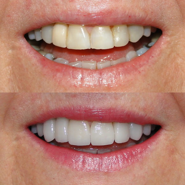 Foto 3 de Gou Odonto Presidente Prudente